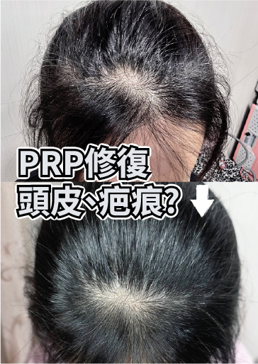圖
